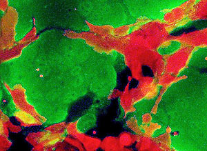 a kanyaró vírus behatol a tumorba